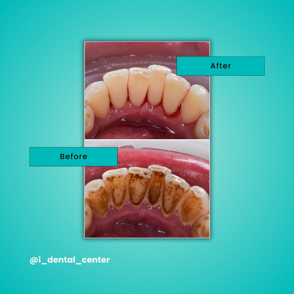 468039734 17947640663870073 8365366091468159900 n